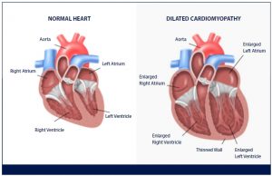 Enlarged Heart (Dilated Cardiomyopathy) In Cats - PetlifeSA